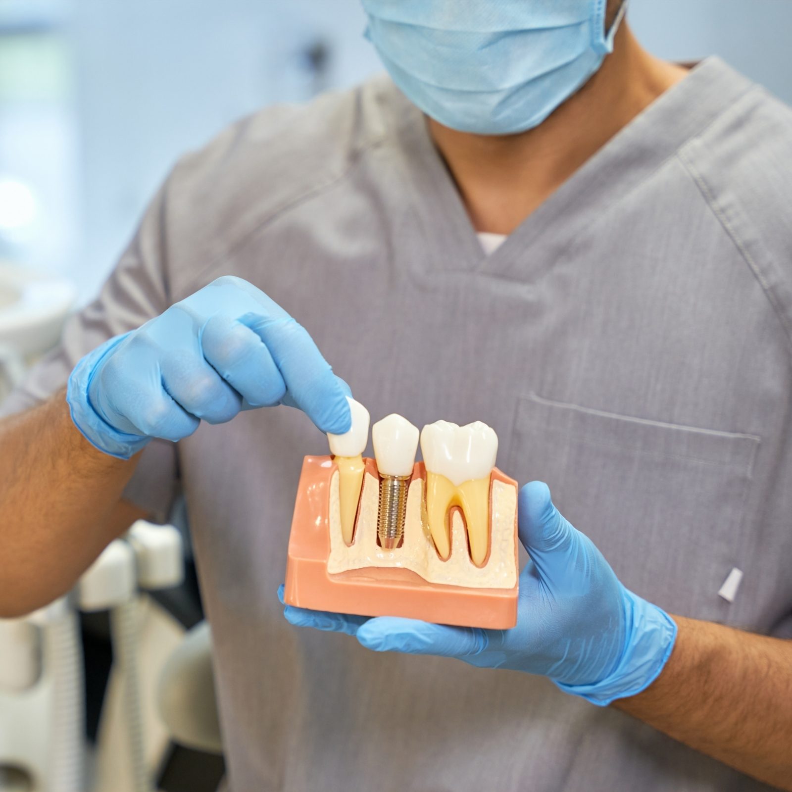 Un modèle de mâchoire tenu en main, avec une vis d’implant posée dans l’os.