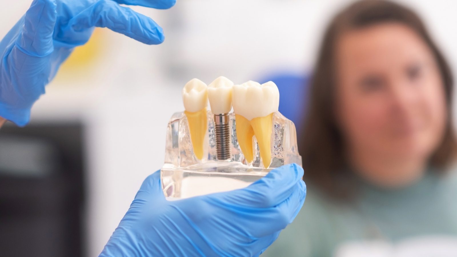 Un modèle de mâchoire présente un implant : la vis en titane et la dent qui se fixe dessus.